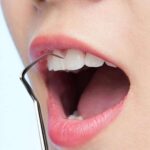 7 Parça Paslanmaz Çelik Ağız Diş Tartar Sökücü Temizlik Bakım Seti - Görsel 5